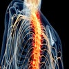 Spinal cord injury - pain - needing relief - alternative treatment